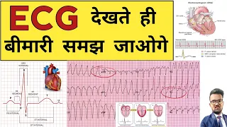 ECG Report | ECG Report Reading | ECG Report kaise Pade | Doctor | Hospital | Nursing | BHMS | BAMS