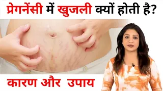 Itching problem during pregnancy || प्रेगनेंसी में खुजली क्यों होती है कारण और  उपाय Sonal Parihaar