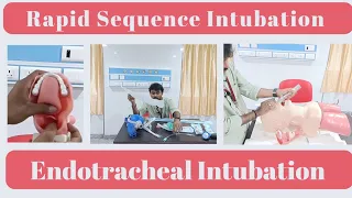 How to do Endotracheal Intubation || RSI Introduction