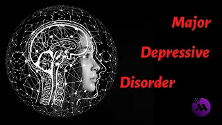 Major depressive disorder (MDD) | DSM-5 diagnostic criteria | Symptoms