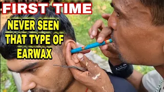 Indian Barber,Unbelievable Earwax Ear Cleaning By Different Tools Must Watch