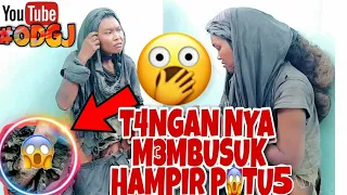 VIRAL❗ ODGJ CEWEK GIMBAL YANG T4NGAN NYA M3MBUSUK MIRIS BANGET 😱