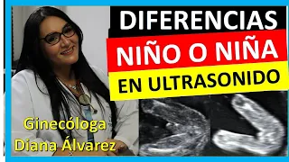 ¿cómo se ve si es NIÑO o NIÑA por ULTRASONIDO?, SEMANA 12 A 20 por GINECOLOGA DIANA ALVAREZ