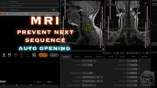 MRI – PREVENT NEXT SEQUENCE AUTO OPENING
