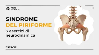 3 esercizi per la Sindrome del Piriforme - Deep Gluteal Syndrome