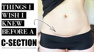 THINGS I WISH I KNEW BEFORE HAVING A C-SECTION | Ciera Sideri