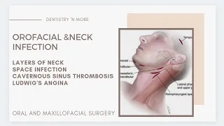 OROFACIAL & NECK INFECTION