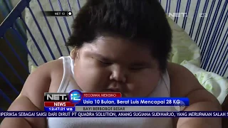 Berbobot 28 Kg, Bayi Asal Meksiko ini Viral di Media Sosial - NET12