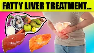 Fatty Liver Treatment | Fatty Liver Diet | Liver Detox | Fatty Liver |  Symptoms | Amazing Tips