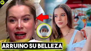 Así es Como Ornella de la Casa de los Famosos Esta Arruinando su Belleza.