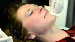 DERMAPEN MICRONEEDLE PAINLESS & EFFECTIVE - Cosmetic Laser MD