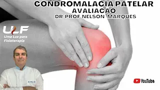 CONDROMALÁCIA PATELAR - AVALIAÇÃO... Dr Prof Nelson Marques