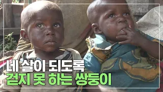 먹을 것이 없어 굶은 엄마로부터 영양 공급을 못 받아 네 살이 되도록 걷지 못 하는 쌍둥이 아기들