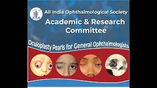 OCULOPLASTY PEARLS FOR GENERAL OPTHALMOLOGISTS