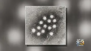 Pennsylvania Health Officials Declare Hepatitis A Outbreak