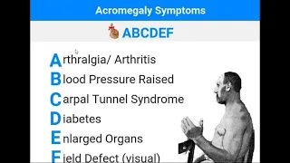 Acromegaly Symptoms Neumonic Picture , Easy To Remember