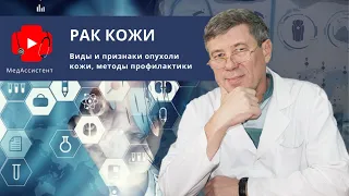 Рак кожи: виды и признаки опухоли кожи, методы профилактики