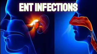 Infections of the Ears, Nose, and Throat - CRASH! Medical Review Series