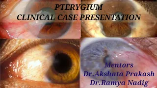 PTERYGIUM