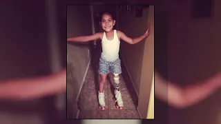 This 8-Year-Old Amputee Dreams of Running