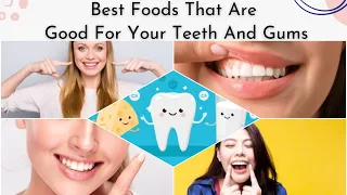 Best Foods To Keep Your Teeth And Gums Strong And Healthy | Foods For Strengthen Your Teeth and Gums