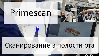 Сканирование полости рта с помощью Primescan