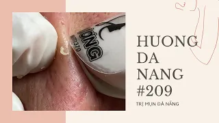 #209 | Huong Da Nang