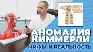 Аномалия Киммерли. Что это? Как лечить?