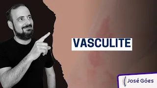 Vasculite | José Góes