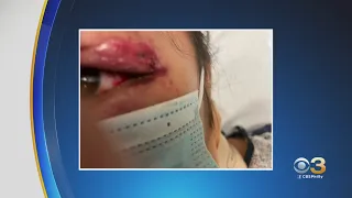 Mother Calls Daughter A Hero After She Intervened In Brutal, Racially Motivated SEPTA Attack