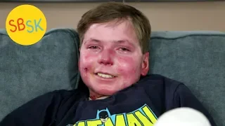 Living in a Body of Open Wounds with Less than Half His Skin (Epidermolysis Bullosa)