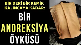 Bir Deri Bir Kemik Kalıncaya Kadar: Bir ANOREKSİYA Öyküsü