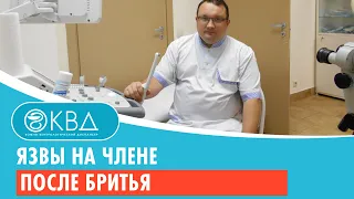 Язвы на члене после бритья. Клинический случай №29