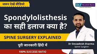 Spondylolisthesis Treatment in Noida | Spondylolisthesis Spine Surgery in Delhi-Dr Devashish Sharma