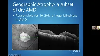 Age-Related Macular Degeneration (AMD) 101