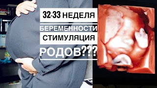 БЕРЕМЕННОСТЬ 32 - 33 НЕДЕЛЯ | МОЯ УЖАСНАЯ ПИГМЕНТАЦИЯ НА ЛИЦЕ | ТРЕТИЙ СКРИНИНГ | СТИМУЛЯЦИЯ РОДОВ?