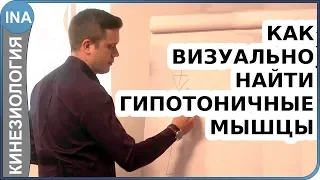 Как визуально определить гипотоничные мышцы. Прикладная кинезиология