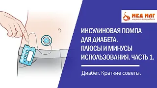 Инсулиновая помпа для диабета. Плюсы и минусы использования. Часть 1.