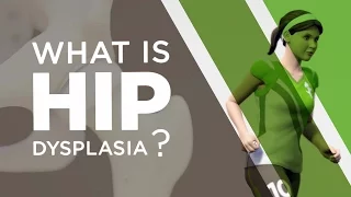 What is Hip Dysplasia?