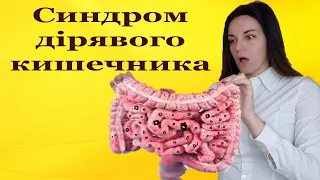 Синдром дірягового кишечника симптоми. Надмірна проникність. Як лікувати синдром дірявого кишечника.