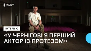 Перший актор на протезі в Чернігові: Юрій Вєткін про втрату ноги, мотивацію та втрати побратимів