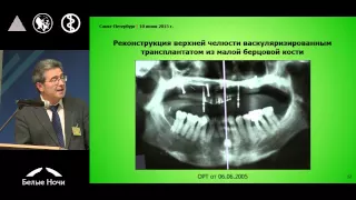 Новые аспекты реабилитации пациентов после реконструктивных операций на челюстях