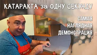 Раскрываю причины возникновения катаракты