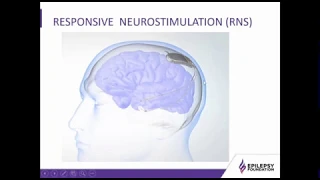 Neurostimulation: A Treatment of Drug Resistant Epilepsy