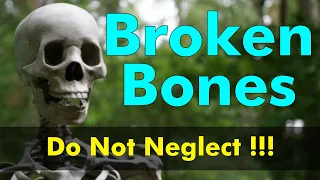 Broken Bones Of Babies 🦴 | Do Not Neglect These Symptoms ! 🛑 | Child Health