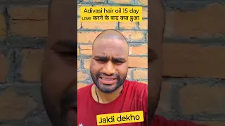 15 day use adivasi hair oil use  क्या हुआ result dekho #adivashioil #hairfall #shortvideo #viral