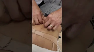 Low Back Skin Rolling To Remove Back Pain