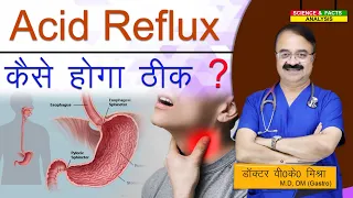 Acid Reflux कैसे होगा ठीक ? || ACID REFLUX HOW IT IS TREATED