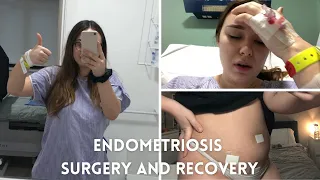 ENDOMETRIOSIS | SURGERY & RECOVERY VLOG | LAPAROSCOPY