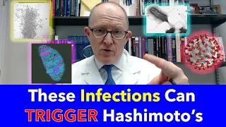 These Infections Can Trigger Hashimoto's Thyroiditis